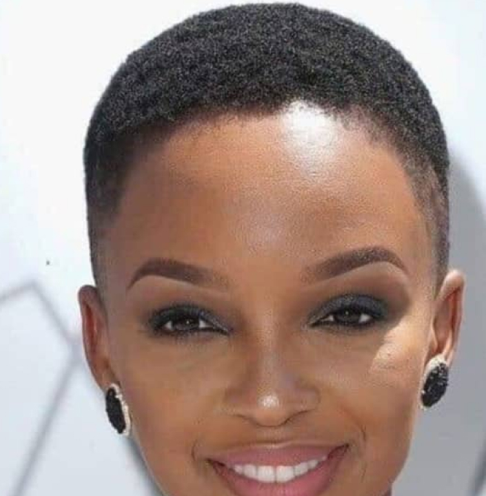 woman suffering hair loss