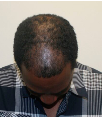 close up of a woman's hair